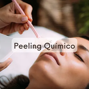 estetica facial peeling quimico